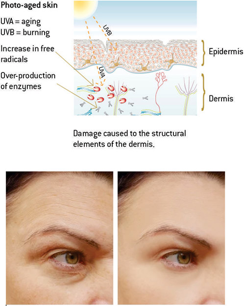 Antioxidant protection